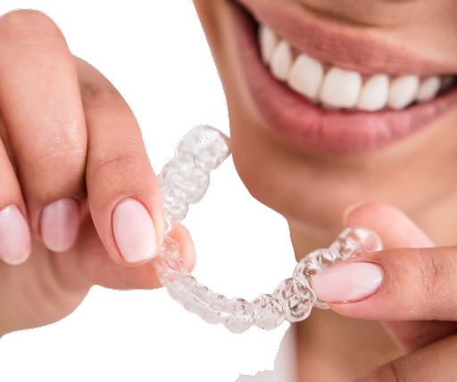 Everything You Need to Know About Retainers
